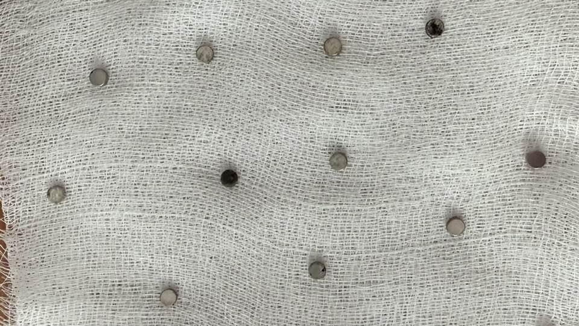 toplam 19 miknatis yemek borusundan cikarildi u8FWyj2t